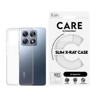 Гръб CARE by PanzerGlass за Xiaomi 14T, Fashion, X-Ray,... - 1 Гръб CARE by PanzerGlass за Xiaomi 14T, Fashion, X-Ray,... - 1