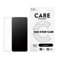 Гръб CARE by PanzerGlass за Xiaomi 17, Fashion, X-Ray,... - 1