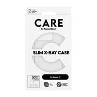 Гръб CARE by PanzerGlass за Xiaomi 17, Fashion, X-Ray,... - 3